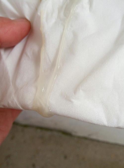 孕期正常白带应是什么状态？颜色、质地、气味有无变化？需警惕哪些异常信号？-第1张图片-郑州医学网