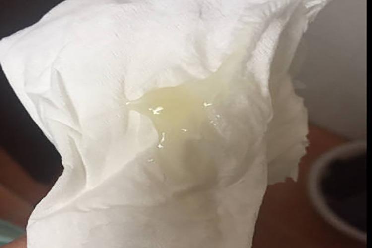 孕期正常白带应是什么状态？颜色、质地、气味有无变化？需警惕哪些异常信号？-第3张图片-郑州医学网