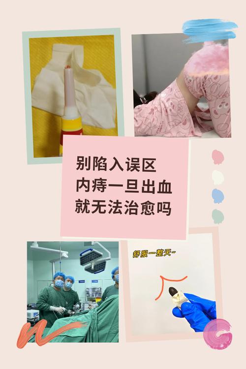 如何缓解孕期痔疮出血-第3张图片-郑州医学网