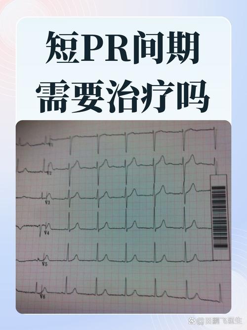 孕期心电图出现短PR间期，对胎儿健康会有哪些潜在影响？-第2张图片-郑州医学网