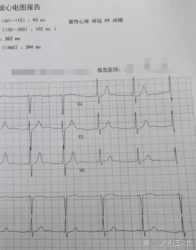 孕期心电图出现短PR间期，对胎儿健康会有哪些潜在影响？-第1张图片-郑州医学网