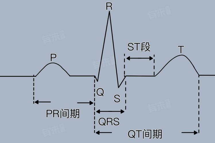孕期心电图出现短PR间期，对胎儿健康会有哪些潜在影响？-第3张图片-郑州医学网