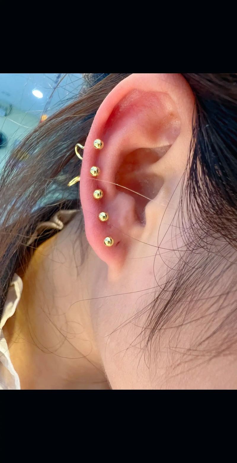 儿童耳朵有耳钉怎么办-第2张图片-郑州医学网