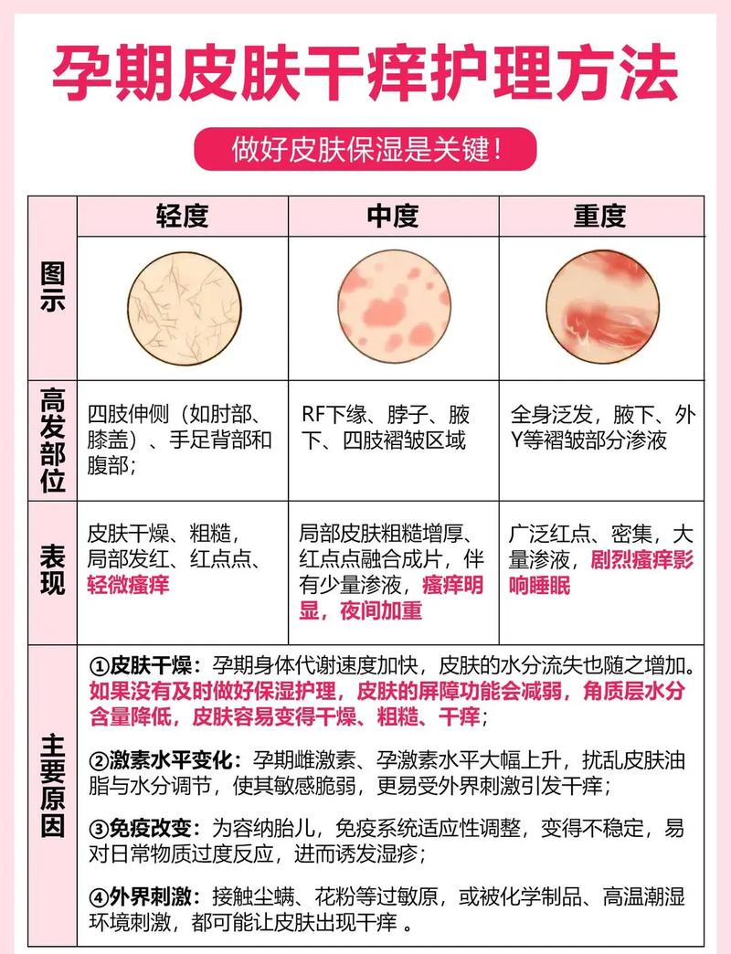 孕期皮肤瘙痒难忍？这5个安全缓解方法，孕妈妈能放心用吗？-第1张图片-郑州医学网