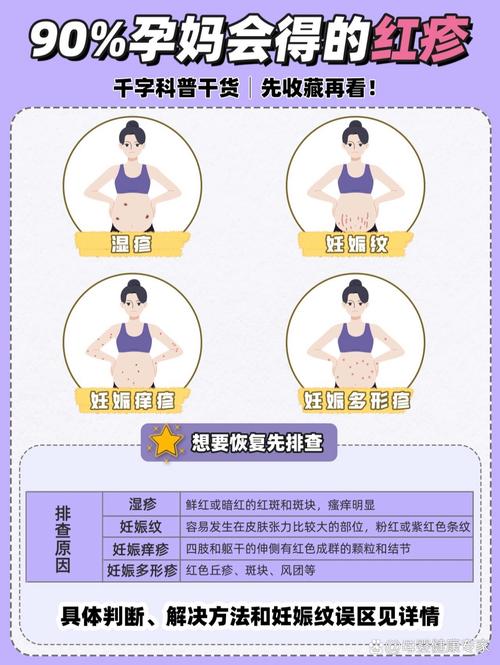 孕期皮肤瘙痒难忍？这5个安全缓解方法，孕妈妈能放心用吗？-第3张图片-郑州医学网