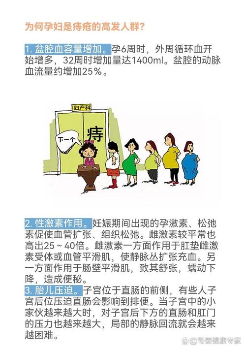 孕期痔疮热敷还是冷敷-第1张图片-郑州医学网