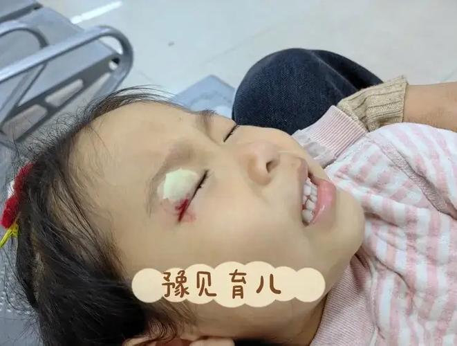 儿童白内障术后会留下哪些后遗症？家长该如何应对和预防？-第1张图片-郑州医学网