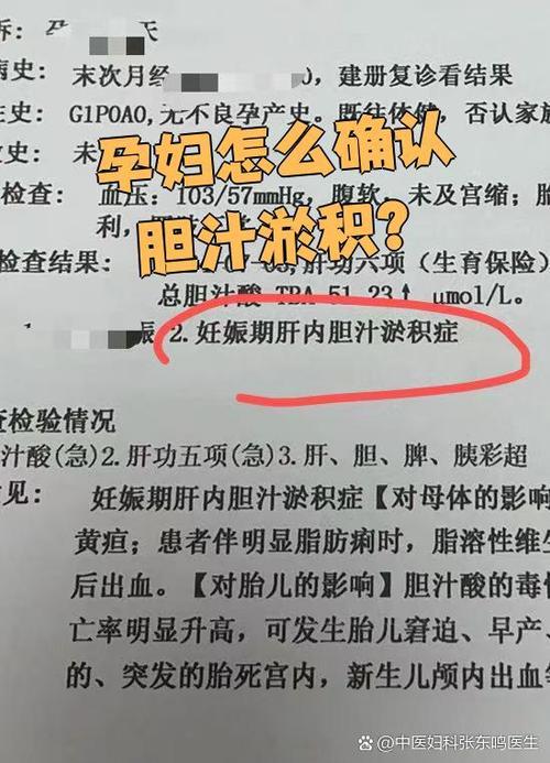 孕期胆汁淤积检查什么-第3张图片-郑州医学网