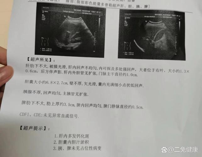 孕期胆汁淤积检查什么-第1张图片-郑州医学网