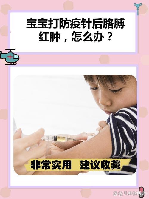 新生儿打完疫苗的反应-第2张图片-郑州医学网