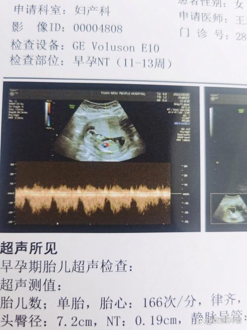 孕期检查nst是什么-第1张图片-郑州医学网