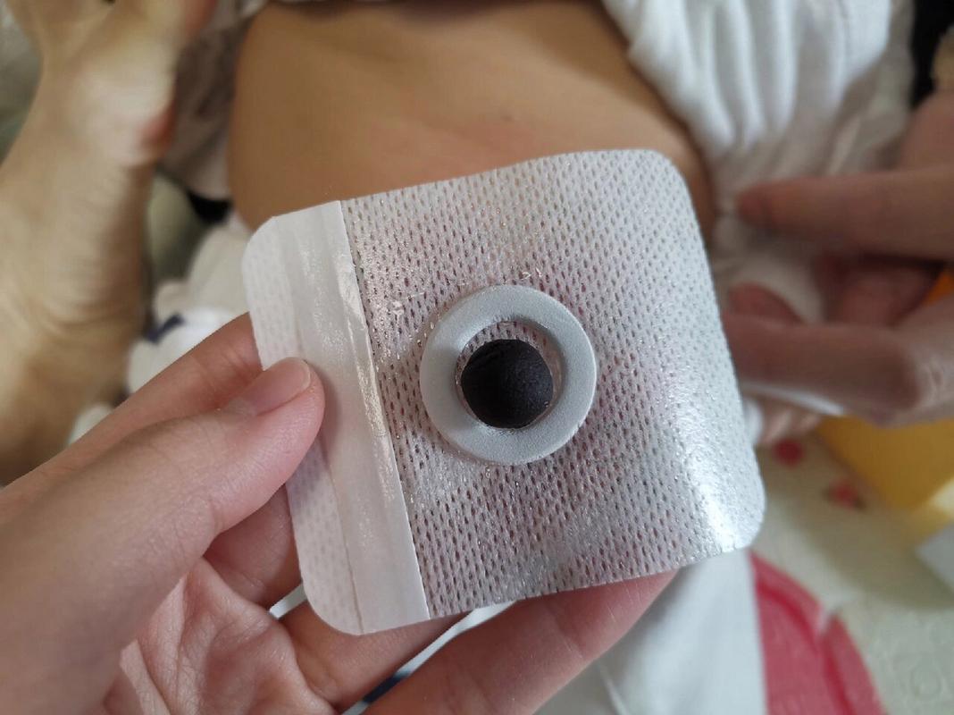 新生儿 胀气 肚脐贴-第3张图片-郑州医学网