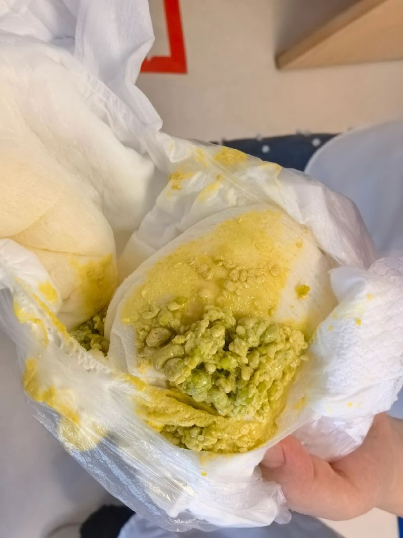 新生儿6天未排便,是正常攒肚还是需警惕的便秘信号?-第1张图片-郑州医学网 新生儿6天未排便,是正常攒肚还是需警惕的便秘信号?-第1张图片-郑州医学网