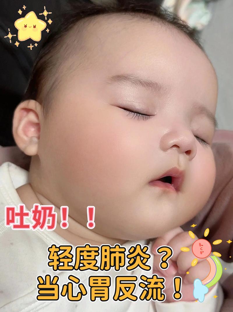 新生儿吐奶是黄绿色的-第2张图片-郑州医学网 新生儿吐奶是黄绿色的-第2张图片-郑州医学网