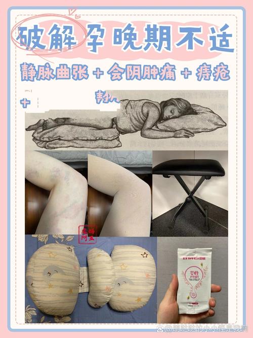 怎样消除孕期阴部水肿-第2张图片-郑州医学网