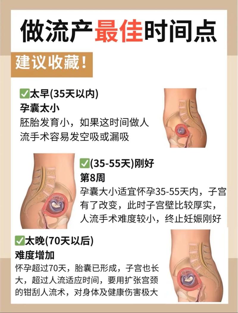 孕期怎样知道自己流产？有哪些典型症状需要警惕？-第1张图片-郑州医学网
