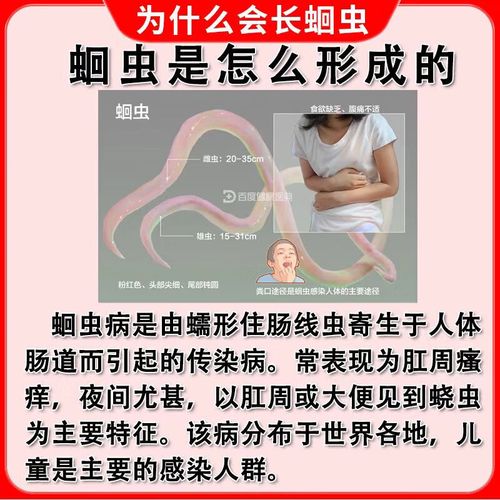 儿童下虫用什么药最好-第2张图片-郑州医学网