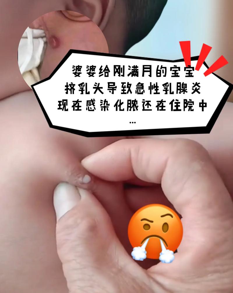 新生儿含着乳头睡觉,到底是对是错?妈妈们该不该阻止?-第2张图片-郑州医学网 新生儿含着乳头睡觉,到底是对是错?妈妈们该不该阻止?-第2张图片-郑州医学网