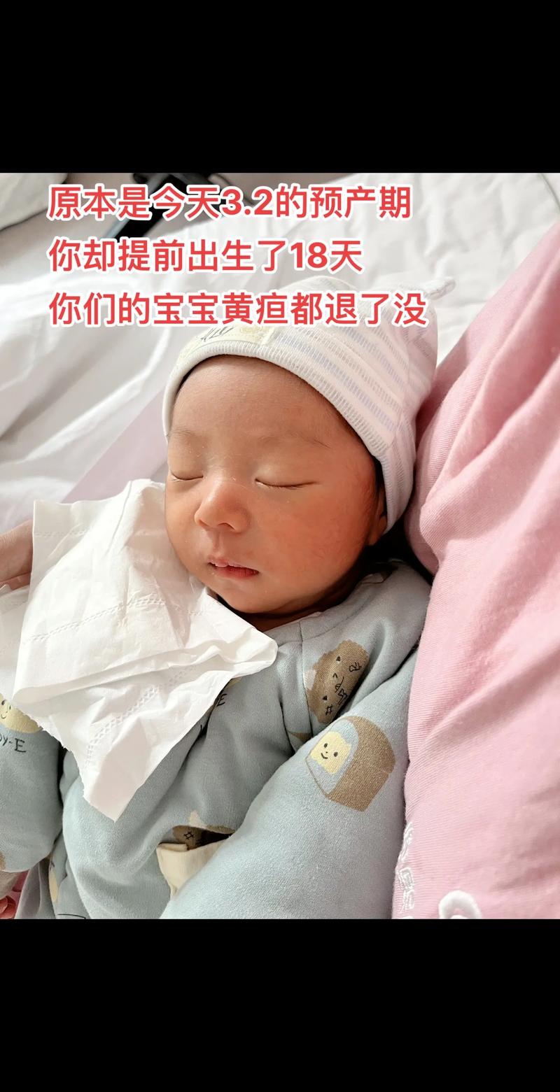 益生菌 黄疸 新生儿-第3张图片-郑州医学网 益生菌 黄疸 新生儿-第3张图片-郑州医学网