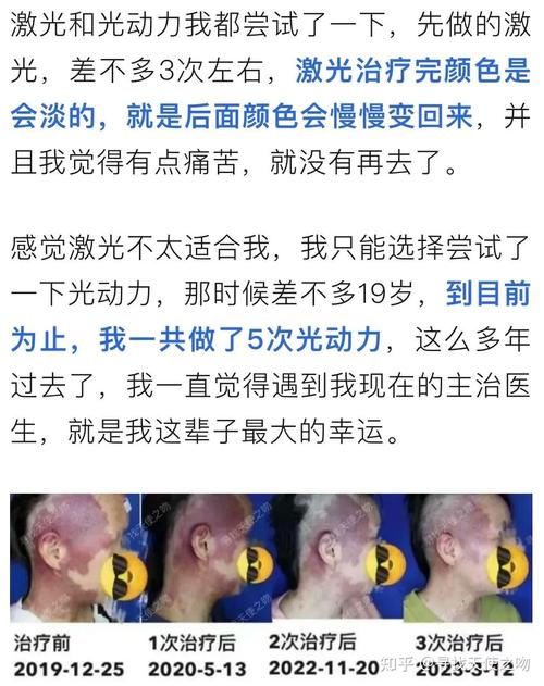 鲜红斑痣和新生儿斑痣-第1张图片-郑州医学网 鲜红斑痣和新生儿斑痣-第1张图片-郑州医学网