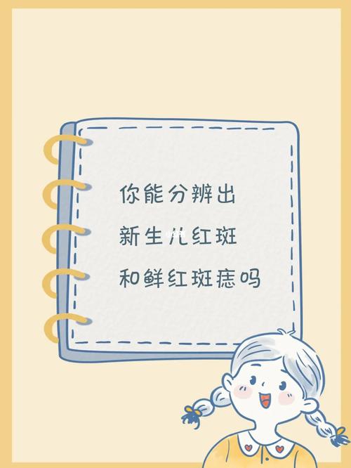 鲜红斑痣和新生儿斑痣-第3张图片-郑州医学网 鲜红斑痣和新生儿斑痣-第3张图片-郑州医学网