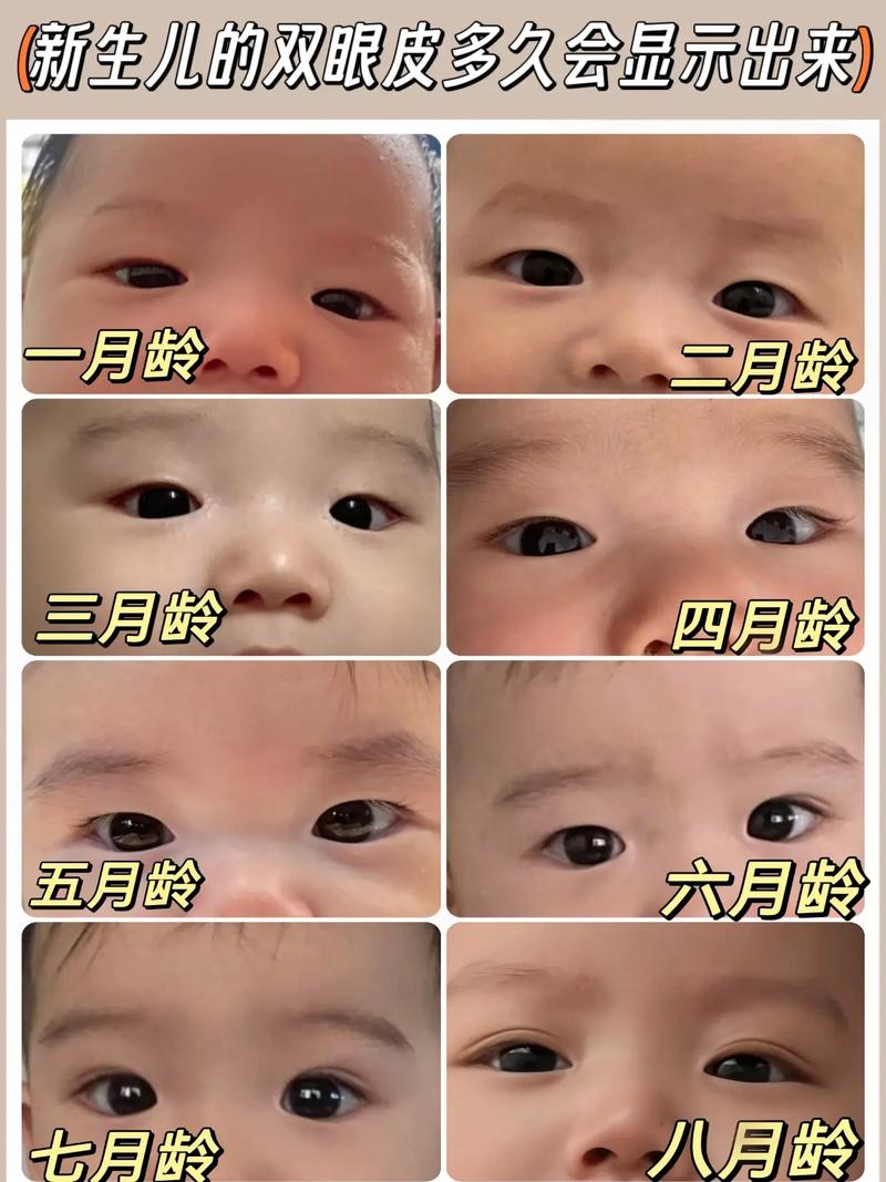 新生儿双眼皮什么时候-第2张图片-郑州医学网 新生儿双眼皮什么时候-第2张图片-郑州医学网