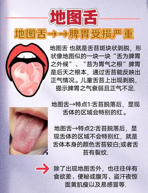 儿童舌头痒是什么原因-第1张图片-郑州医学网 儿童舌头痒是什么原因-第1张图片-郑州医学网