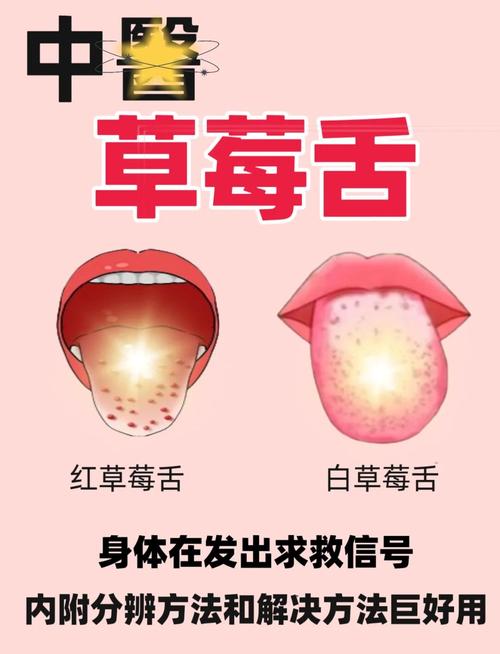 儿童舌头痒是什么原因-第3张图片-郑州医学网