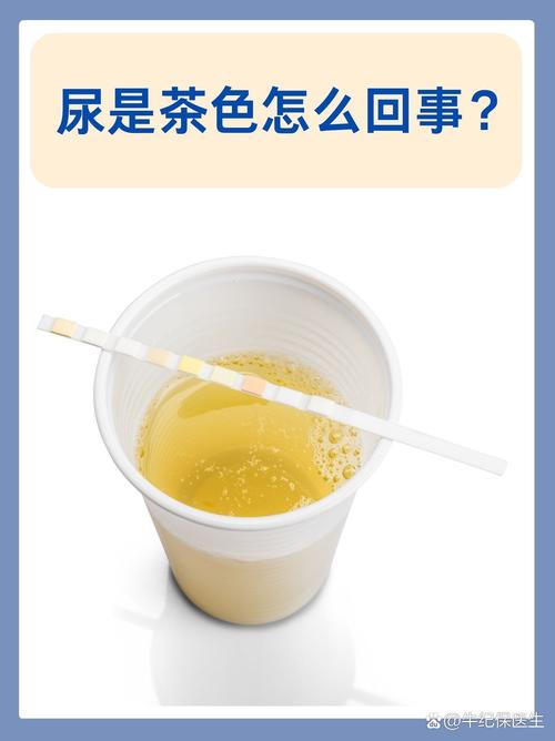 儿童尿是茶色怎么回事-第2张图片-郑州医学网