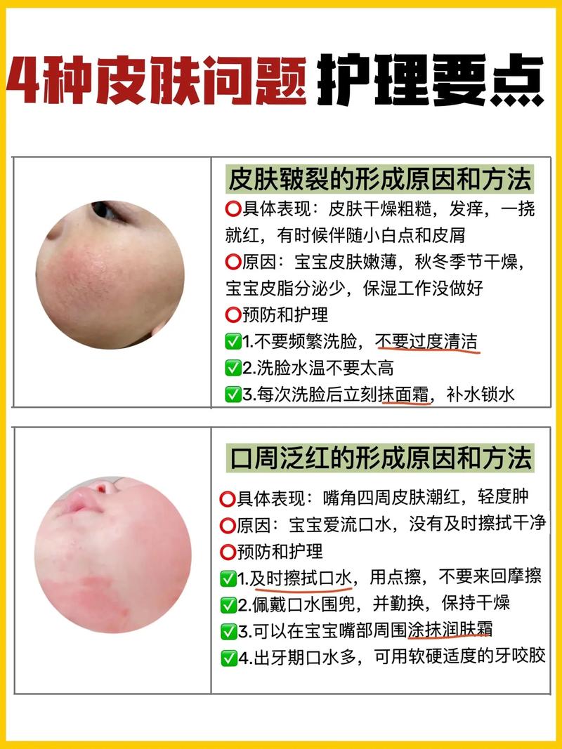 儿童脸上鸡皮肤怎么办-第1张图片-郑州医学网