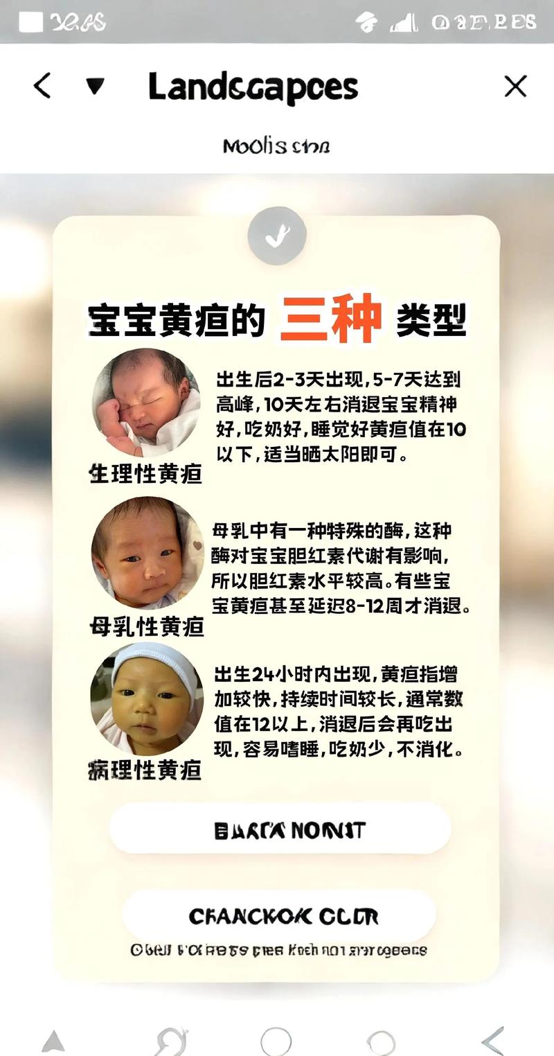 黄疸 转氨酶 新生儿-第1张图片-郑州医学网