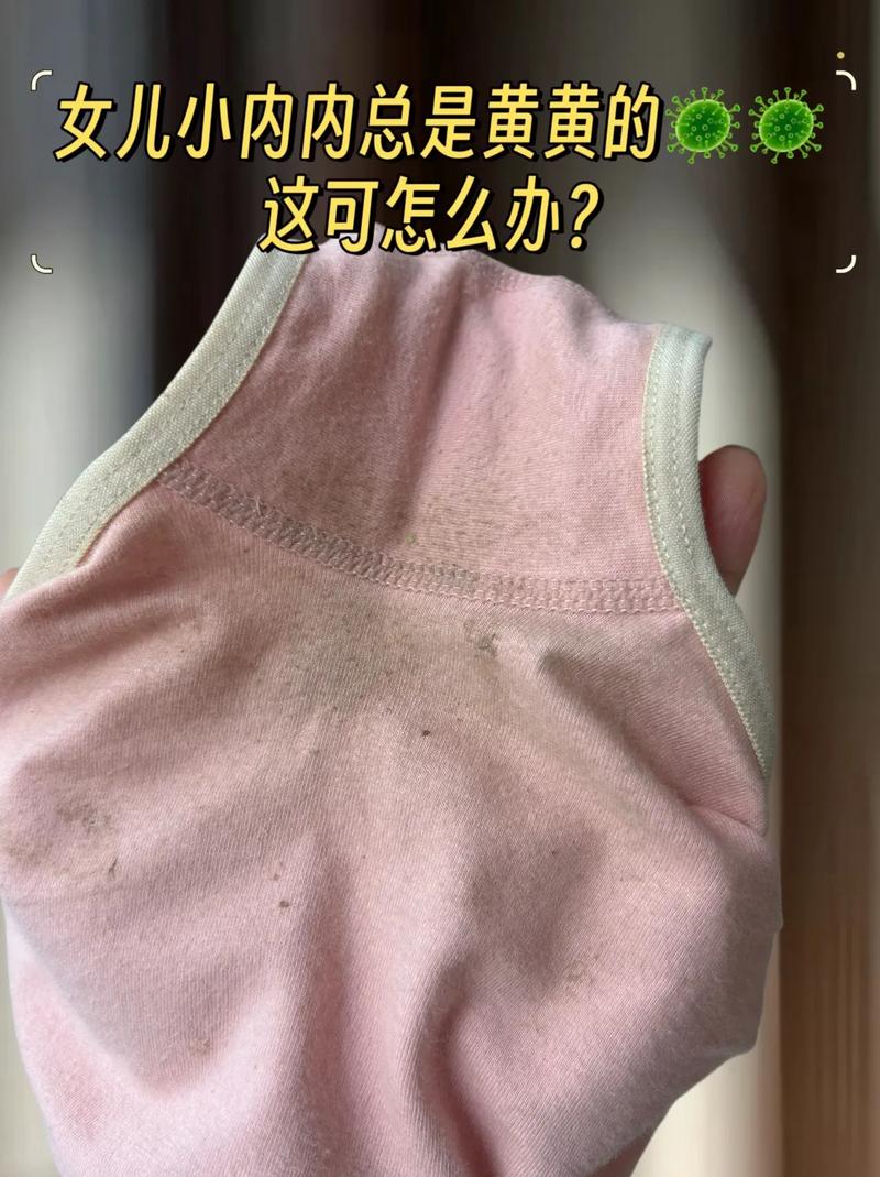 怀孕期间内裤总是湿的，是正常生理变化还是异常信号？-第1张图片-郑州医学网