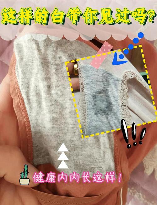 怀孕期间内裤总是湿的，是正常生理变化还是异常信号？-第2张图片-郑州医学网