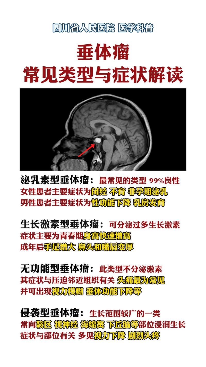 儿童脑部垂体瘤严重吗？早发现早治疗能控制病情吗？-第2张图片-郑州医学网