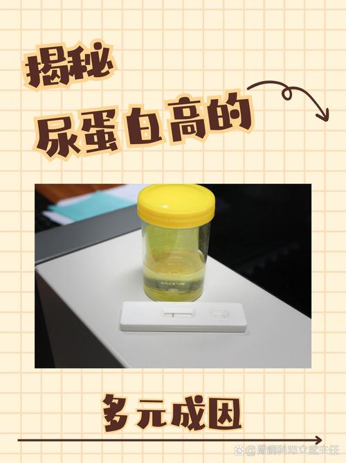 怀孕期间尿蛋白3个加，是肾脏出问题了吗？对胎儿有影响吗？-第3张图片-郑州医学网