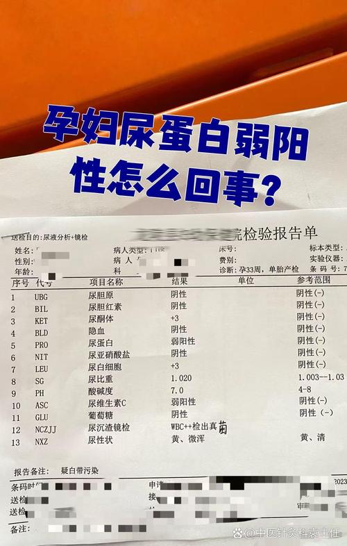 怀孕期间尿蛋白3个加，是肾脏出问题了吗？对胎儿有影响吗？-第2张图片-郑州医学网
