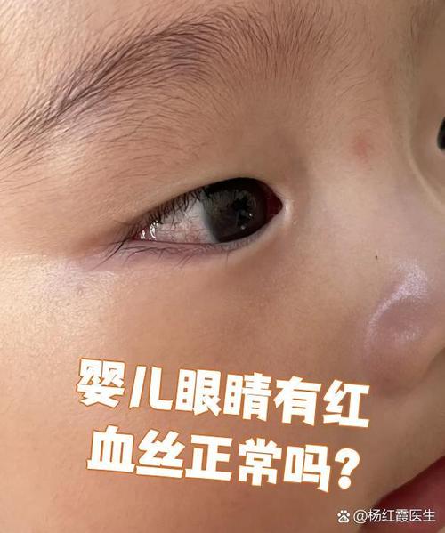 新生儿眼睛颜色会随时间变化吗？从蓝到黑的转变背后是什么在决定？-第2张图片-郑州医学网