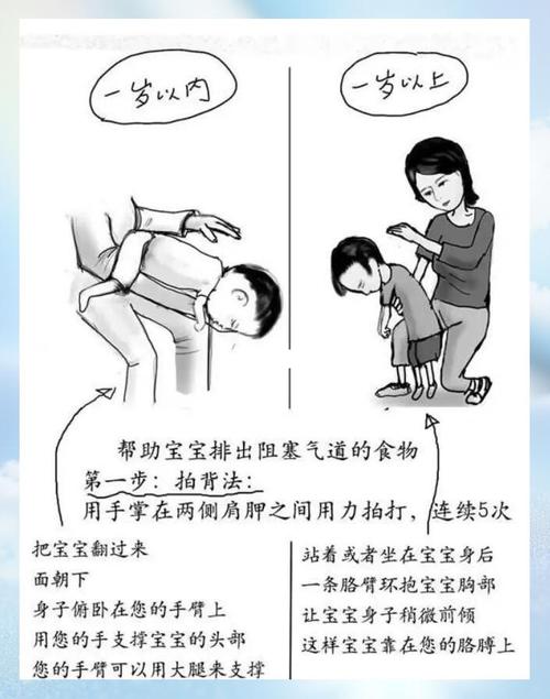 儿童吃东西卡住怎么办-第3张图片-郑州医学网