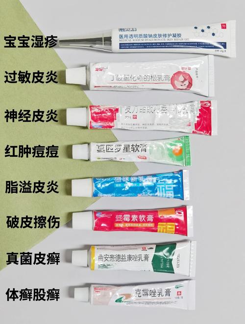 儿童湿疹膏什么牌子好-第1张图片-郑州医学网