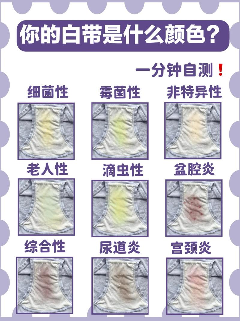 怀孕期间有白带正常么-第1张图片-郑州医学网