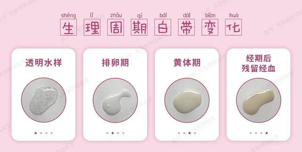 怀孕期间有白带正常么-第2张图片-郑州医学网