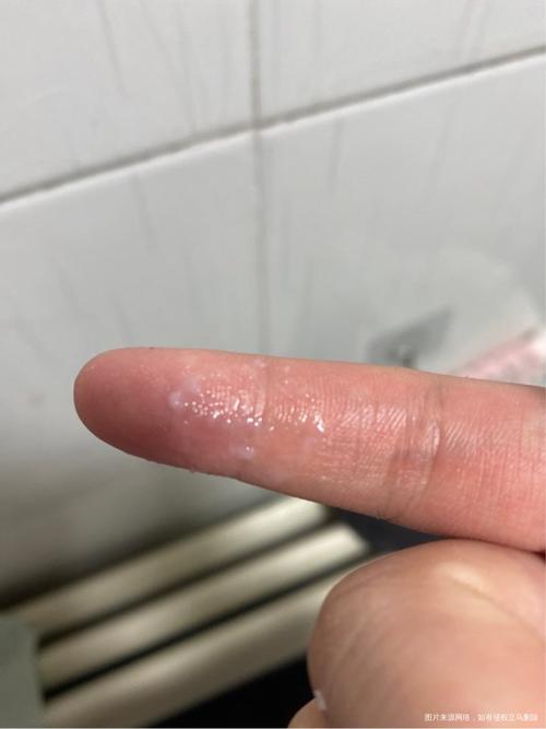 怀孕期间有白带正常么-第3张图片-郑州医学网