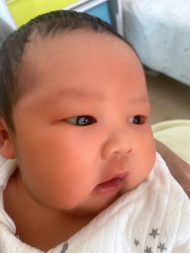 新生儿睁眼只睁一只是异常表现吗？需警惕哪些潜在问题？-第1张图片-郑州医学网