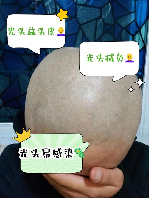 怀孕期间剃光头的好处-第2张图片-郑州医学网