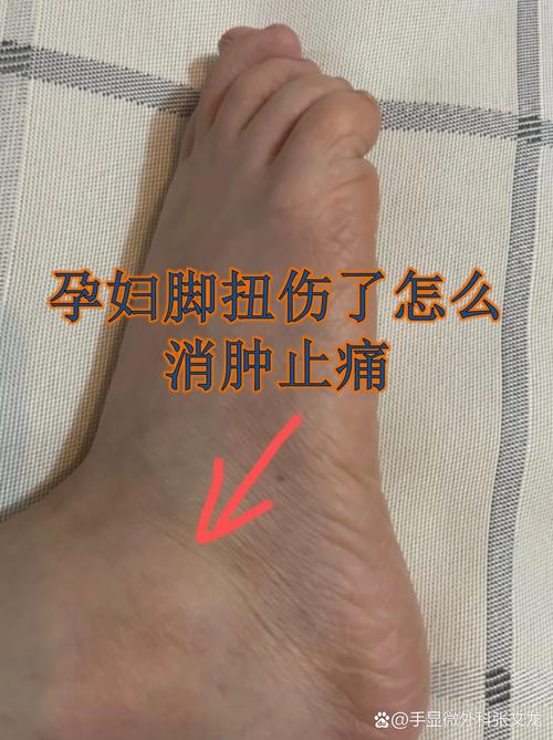 孕期脚丫子烂了又痒又痛，到底该怎么办才安全有效？-第1张图片-郑州医学网