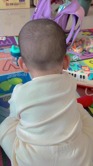 新生儿剃头发型后脑勺头发稀少怎么办？会影响头皮健康吗？-第1张图片-郑州医学网