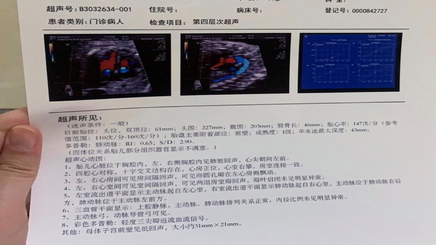 新生儿三尖瓣重度返流能自愈吗？需立即手术吗？对发育有何影响？-第1张图片-郑州医学网