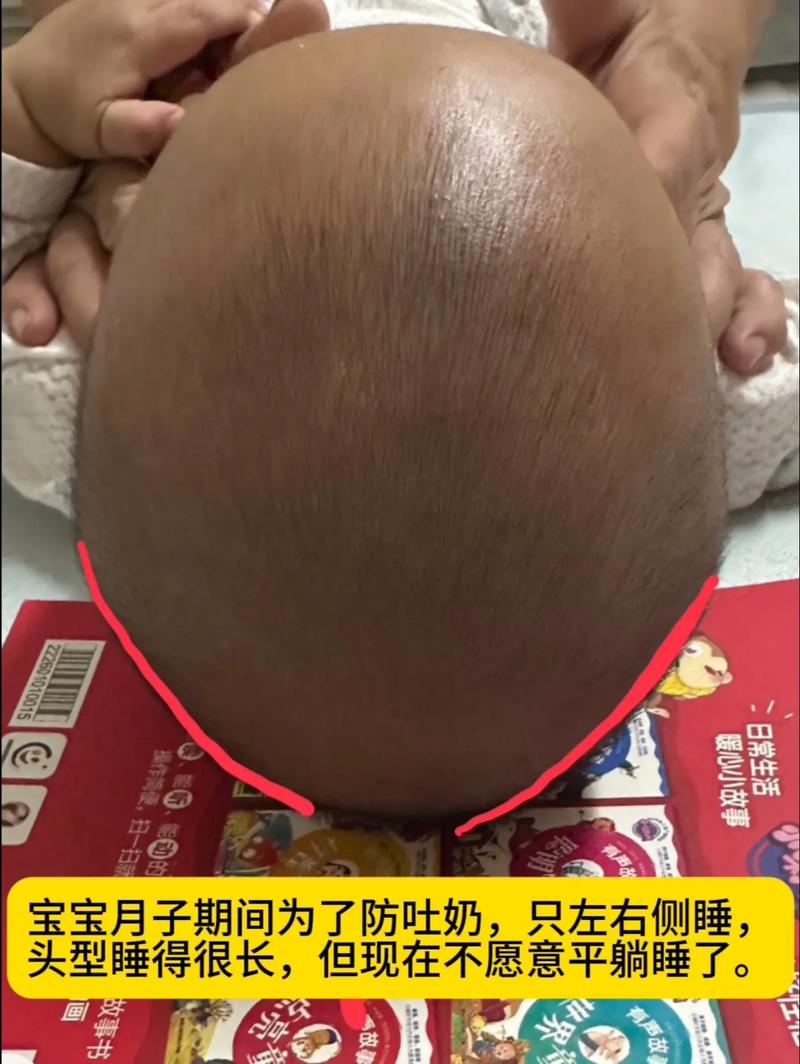 新生儿24小时不睡觉是异常信号还是正常生理现象?-第1张图片-郑州医学网 新生儿24小时不睡觉是异常信号还是正常生理现象?-第1张图片-郑州医学网