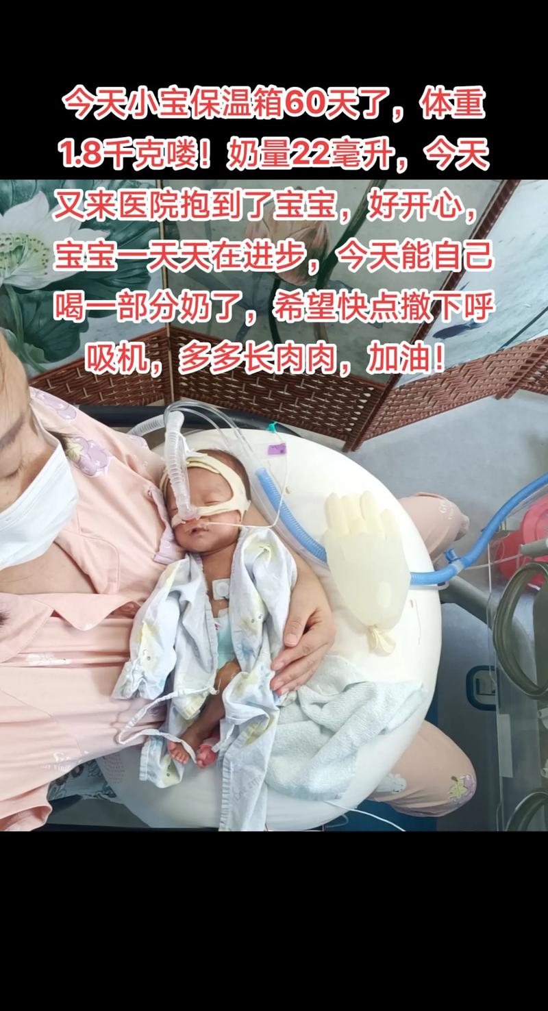 新生儿保温箱温度到底是多少度？不同日龄、体重的新生儿保温箱温度有区别吗？-第2张图片-郑州医学网