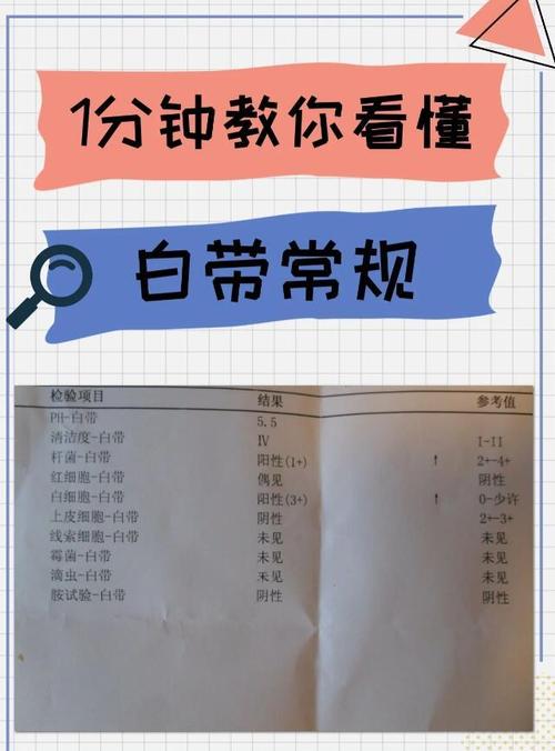 怀孕期间白带检查有必要做吗？异常情况如何应对？-第1张图片-郑州医学网